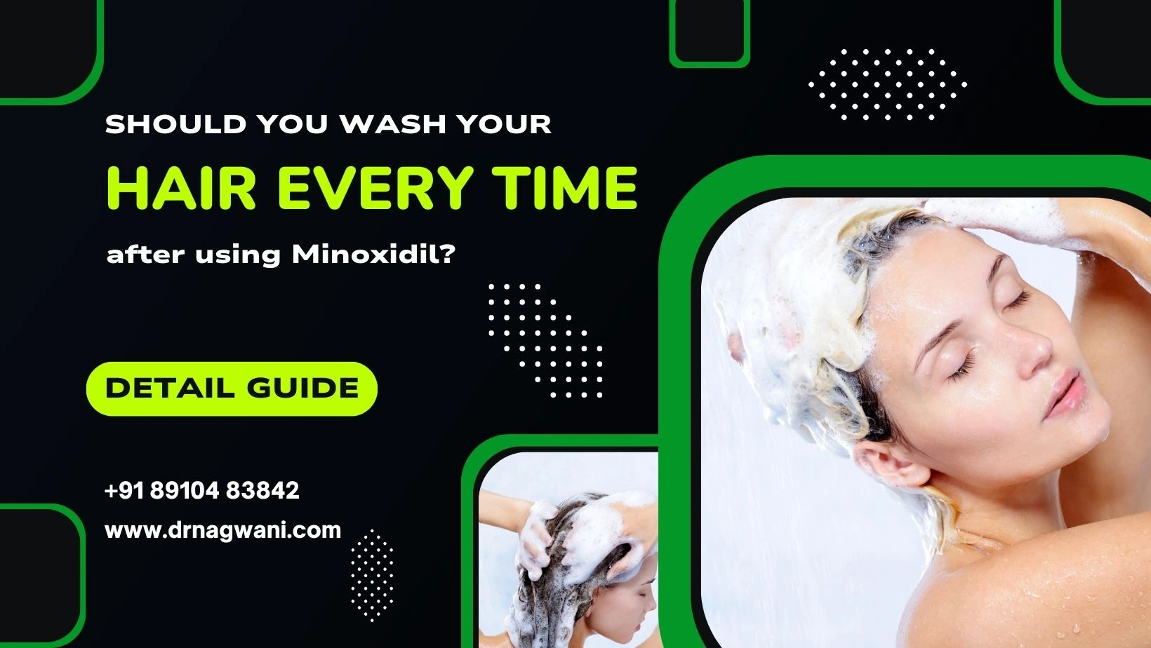 You are currently viewing Should you wash your hair every time after using Minoxidil?