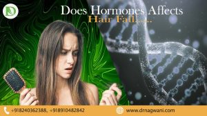 Read more about the article Does Hormones Affects Hair Fall: Comprehensive Guide