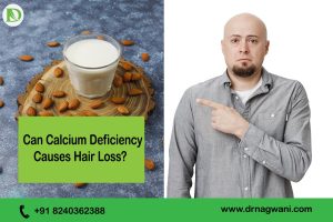 Read more about the article Can Calcium Deficiency Causes Hair Loss? Hidden Facts