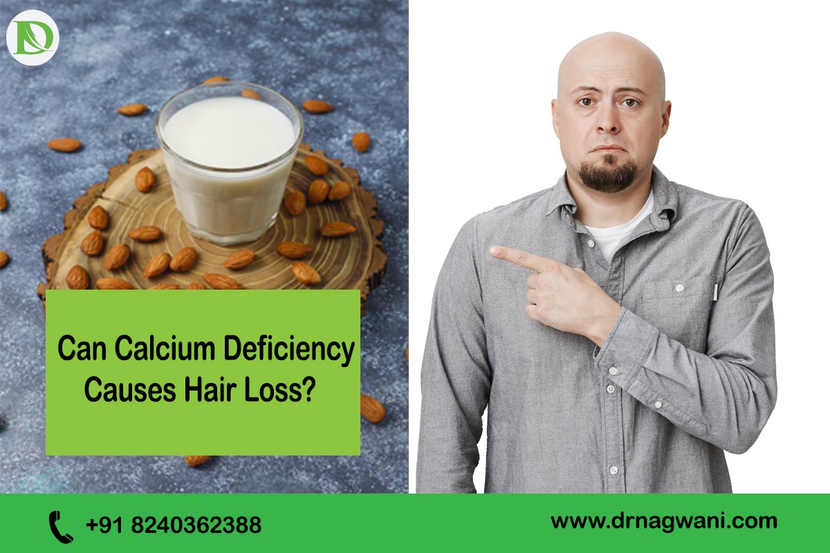 You are currently viewing Can Calcium Deficiency Causes Hair Loss? Hidden Facts