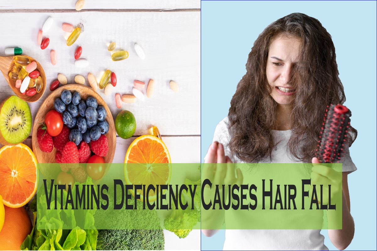 You are currently viewing Vitamins Deficiency Causes Hair Fall