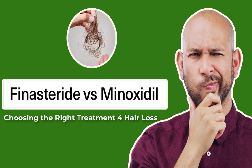Read more about the article Minoxidil vs. Finasteride Choosing the Right Treatment 4 Hair Loss