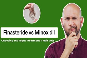 Read more about the article Minoxidil vs. Finasteride Choosing the Right Treatment 4 Hair Loss