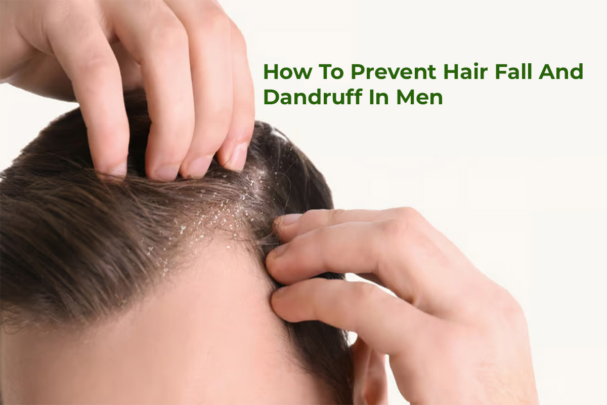 You are currently viewing How To Prevent Hair Fall And Dandruff In Men: Call 8240362388