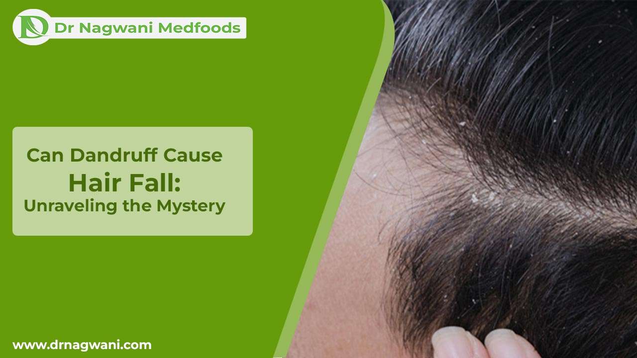 You are currently viewing Can Dandruff Cause Hair Fall: Unraveling the Mystery