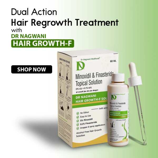 hair loss products for men