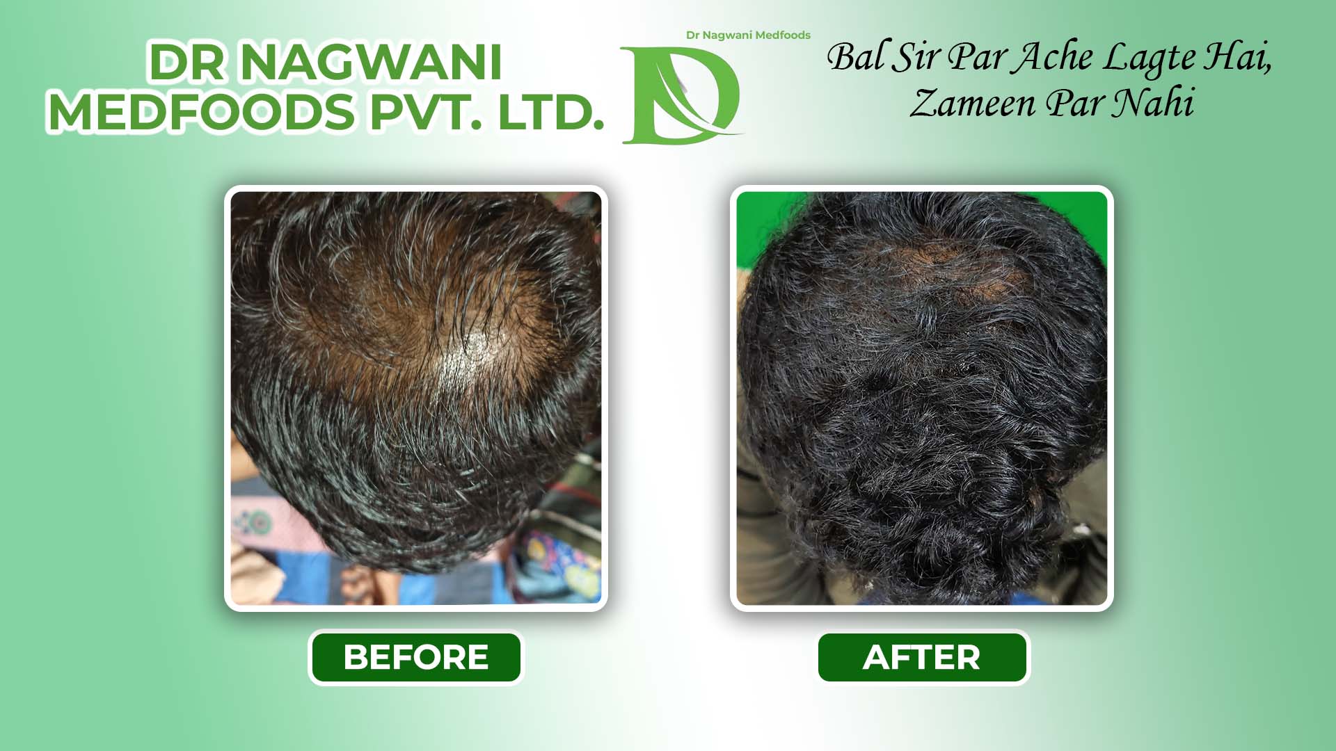 Medfoods B&A result-2