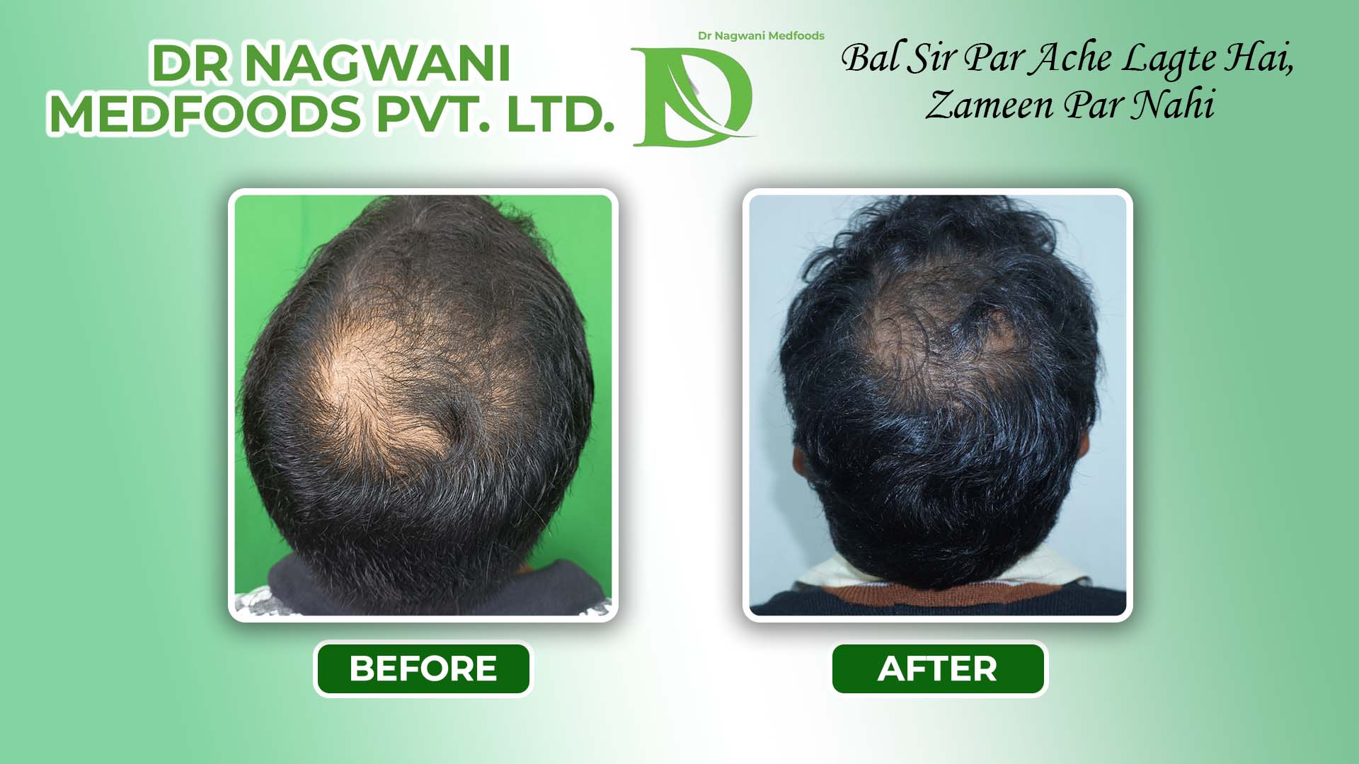 Medfoods B&A result-4