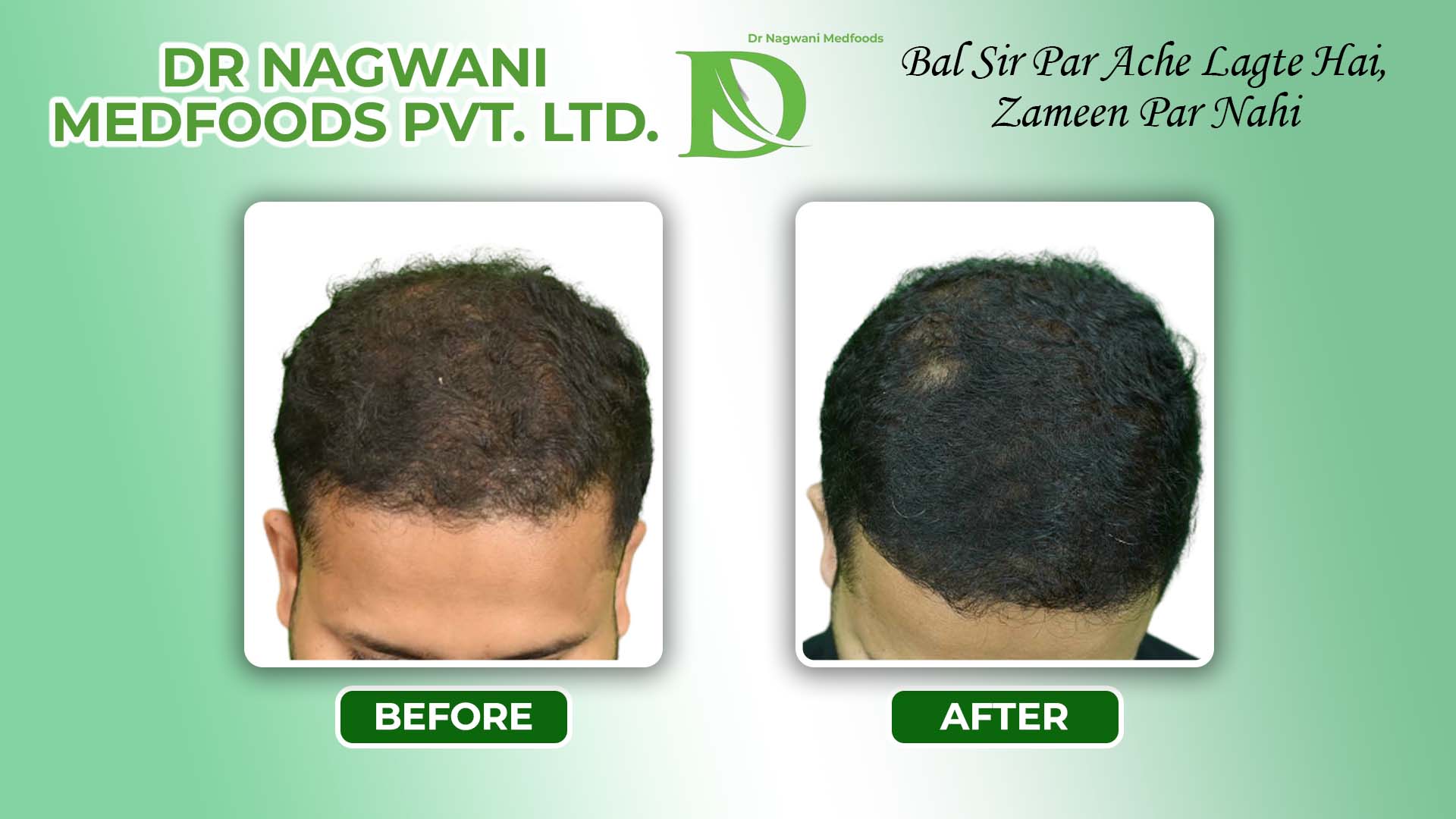 Medfoods B&A result-7