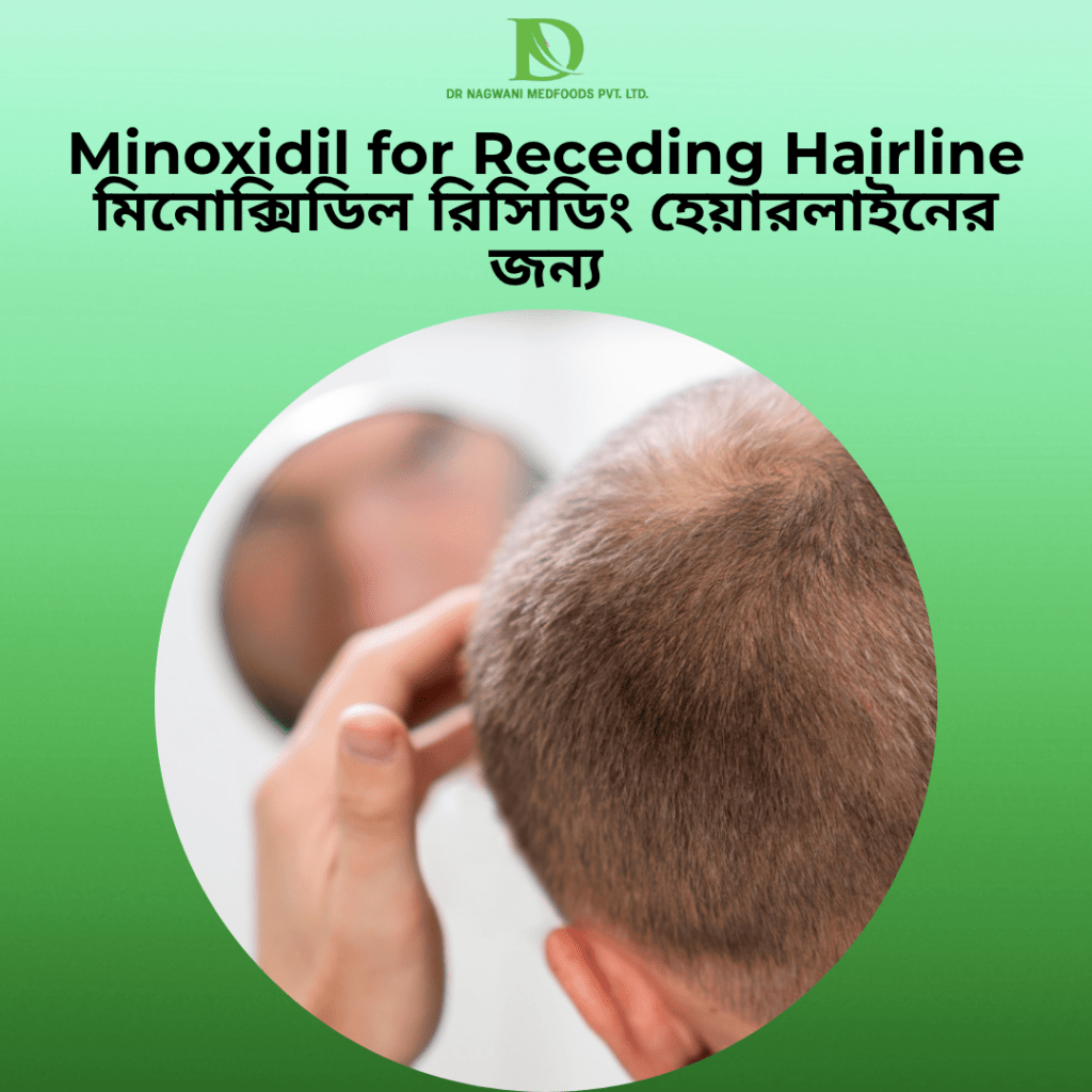 Minoxidil for Receding Hairline
